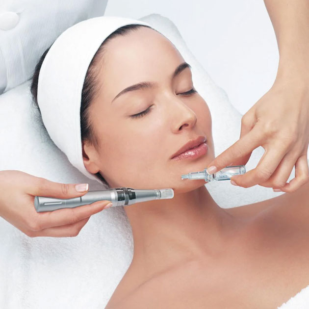 microneedling